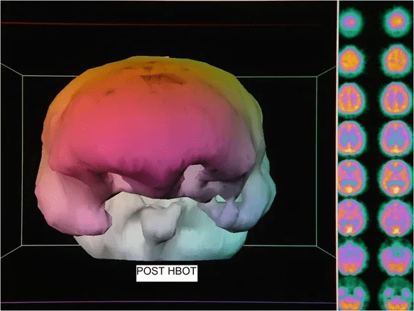 post traumatic stress disorder, ptsd, ptsd treatment, signs of ptsd, post traumatic stress, ptsd diagnosis, stress disorder, complex post traumatic stress disorder, types of ptsd, post traumatic, post traumatic stress disorder, ptsd treatment, signs of ptsd, post traumatic stress, ptsd diagnosis, stress disorder, complex post traumatic stress disorder, types of ptsd, post traumatic,