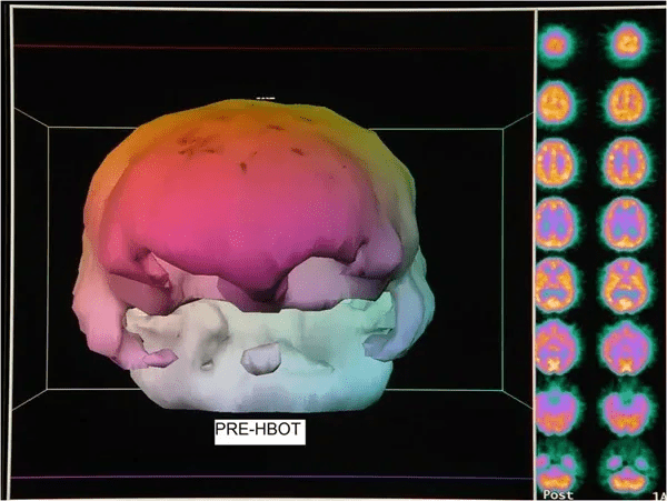 post traumatic stress disorder, ptsd, ptsd treatment, signs of ptsd, post traumatic stress, ptsd diagnosis, stress disorder, complex post traumatic stress disorder, types of ptsd, post traumatic, post traumatic stress disorder, ptsd treatment, signs of ptsd, post traumatic stress, ptsd diagnosis, stress disorder, complex post traumatic stress disorder, types of ptsd, post traumatic,